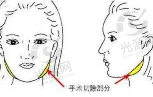 总结