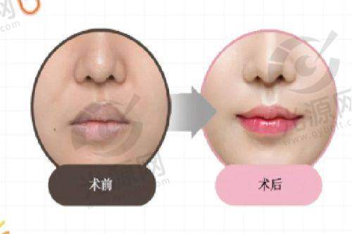 余乐华实例：真实用户的改变故事