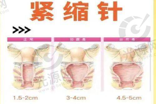 姚乃君医生的专精背景与特色技术