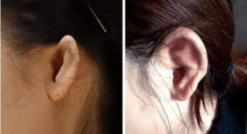 液态水分子丰胸的维持时间