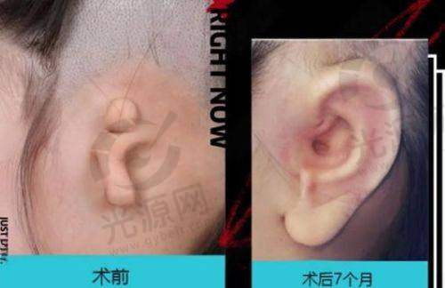三、宁波首美整形医院口碑如何？不妨来看集美们的实例评价