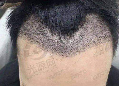 总结：吕淑珍医生值得信赖的选择