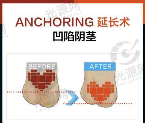 三、沈阳圣优国内外整形医院的口碑实例分享