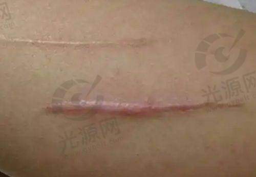 二、广州美容医院排行详细介绍