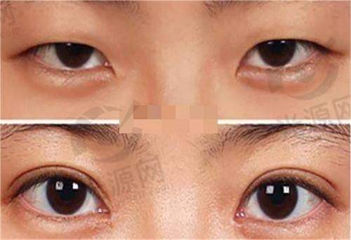 10. 天水爱尔眼科医院整形科 - 精专于眼部美容