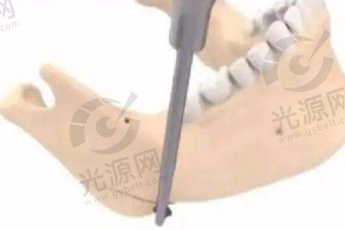 总结