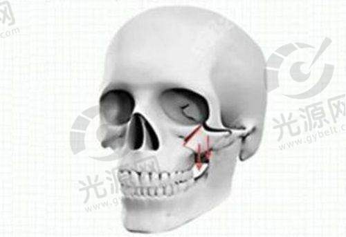 三、杏林整形医院的良好口碑与实例分享