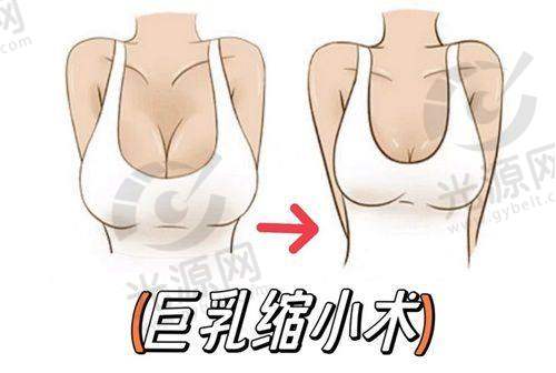 郑州美艺整形医院地址曝光，专业眼部整形修复，孔宇医生助你重拾自信与美丽！