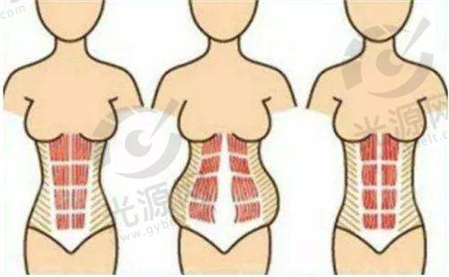 一、惠州伊丽莎白整形医院的基本资料和成就
