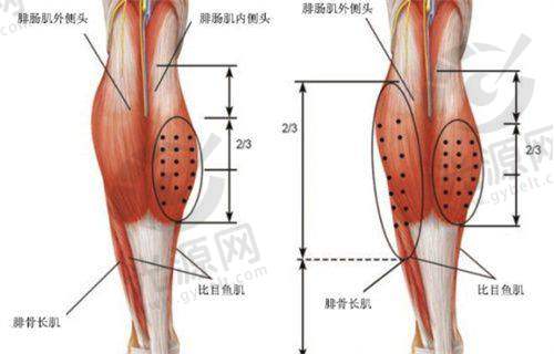 三、XX地区XX项目收费情况