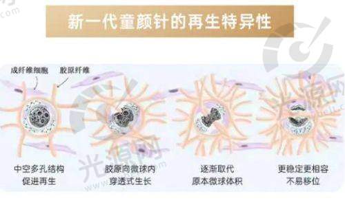 韩国德媄娜蛋白线的品牌优势分析