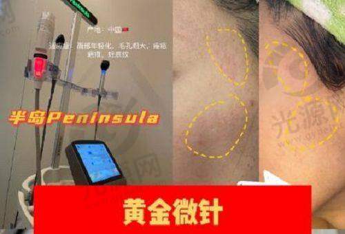 二、鄂尔多斯割双眼皮医院详细介绍