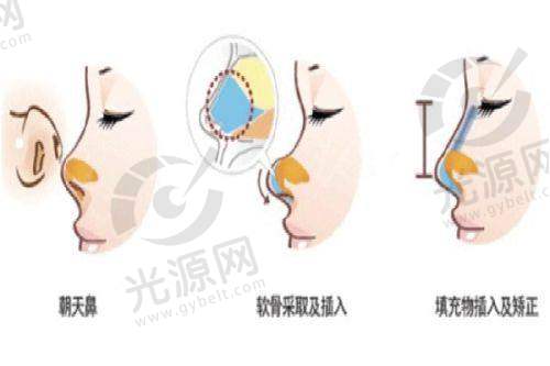 Fotona治疗成效的持久性
