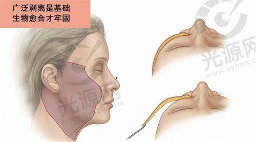 郑州明眸整形医院怎么样？眼部整形技术、安全性及医院环境全解析！