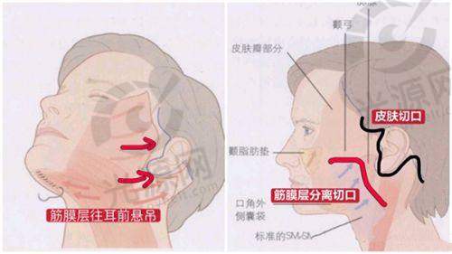 五、成都美雅娜预约挂号攻略