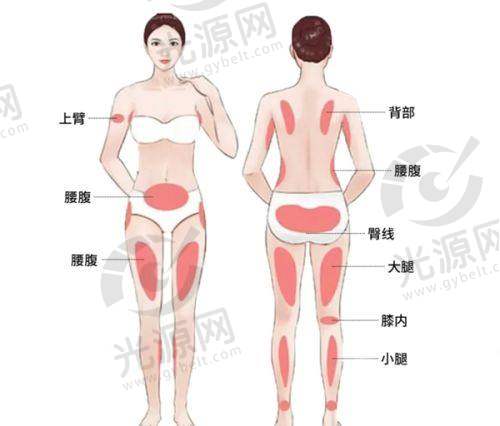Fotona与菲蜜丽的价格对比