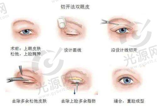 5g天使光雕不同部位价格详情