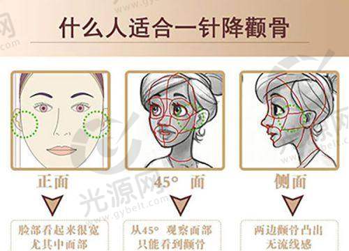 五、医生预约挂号攻略