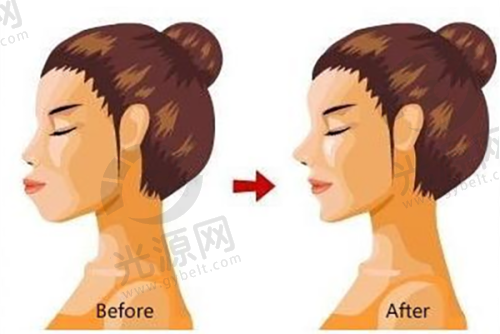 如何预约吕淑珍医生的挂号?