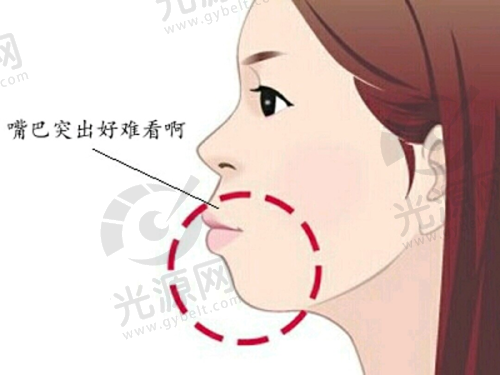 三、武汉整形医院M嘴项目收费情况