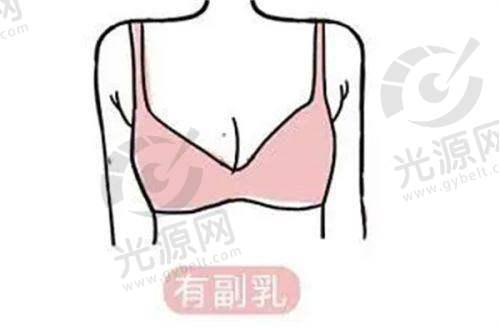 总结