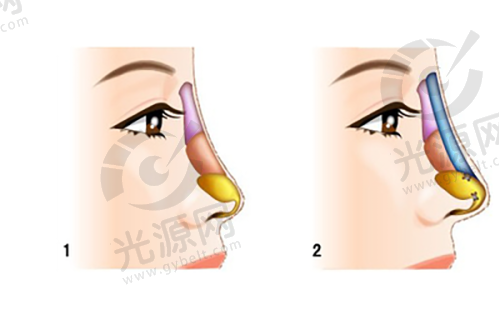 保定华美整形医院电话查询及地址信息，了解双眼皮、隆鼻等热门项目价格与服务体验