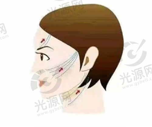 二、威塑吸脂vaser国内哪里有每家医院的详细介绍
