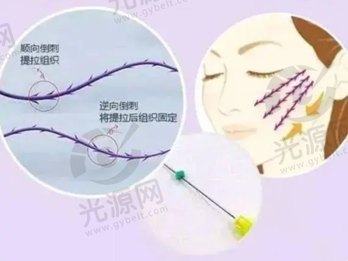 爱美客嗨体安心性高，成分可靠