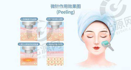 液态水分子丰胸价格概述