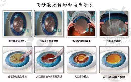 二、萍乡优美整形医院擅长的项目技术优势