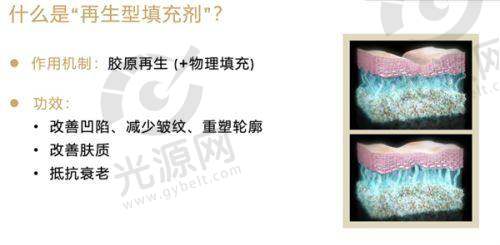 郭震宇自体脂肪丰胸费用一览