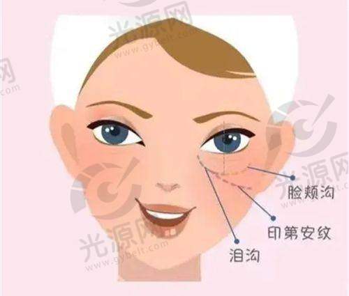 美容青春支架维持时间与成效