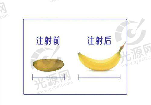 万州丽星整形医院的特色项目