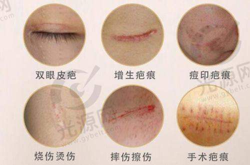 三、患者反馈——十堰海菲美容医院的真实实例分享