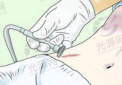 铜雀台刘溪医生简介