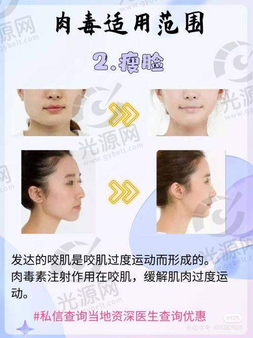 7. 广州美莱整形医院