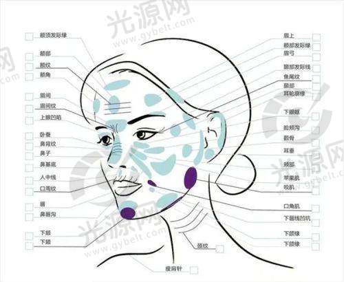 德国PCL线的实例分享