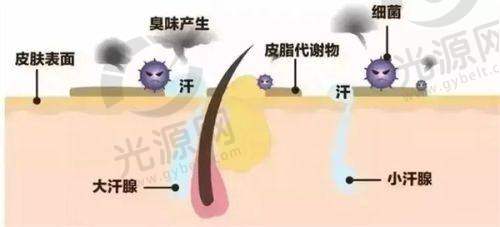 美容青春支架与其他技术的比较