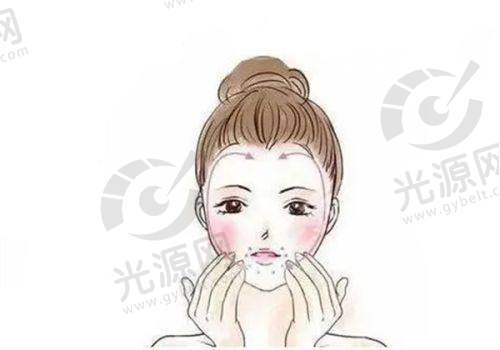 绿毒瘦脸针的成效持续时间