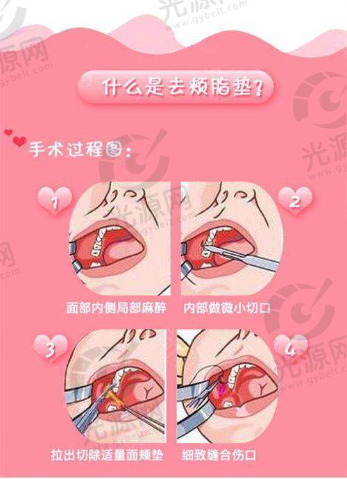 三、济南整形医院整体项目收费情况