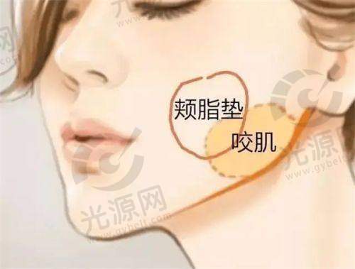 郑颖平医生的双眼皮手术技术