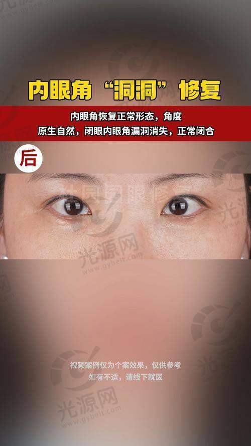 总结：王焕医生带给你的自然之美