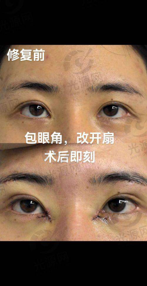 预约挂号：简单便捷的方式