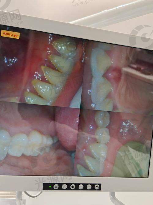 1. 南昌德韩口腔