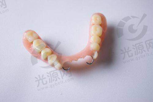 钢托义齿的优缺点分析