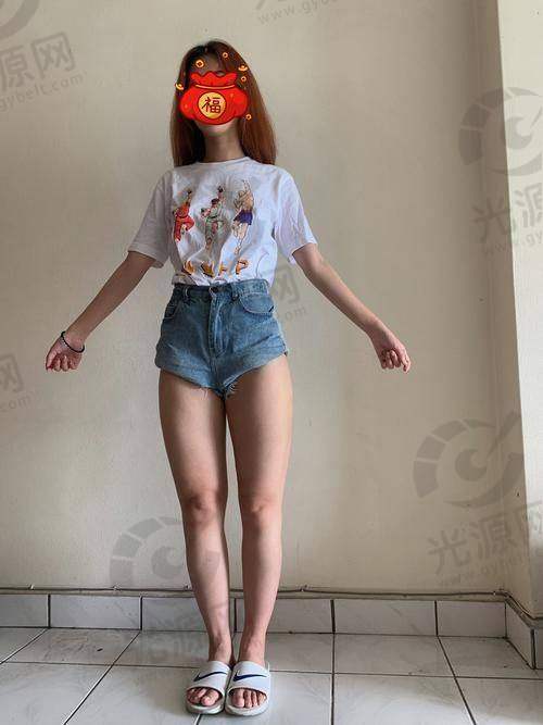 吸脂手术后的护理与修复