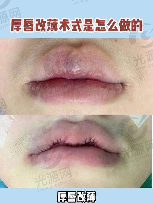 反弹的影响因素
