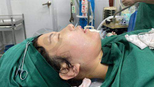 明星为什么不做面部吸脂？揭示吸脂手术的风险与真相，了解明星的减肥秘诀与面部管理技巧