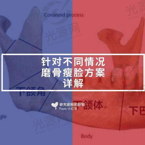 杭州时光陈小平医生下颌角磨骨与颧骨整形技术评析，价格透明，真实案例分享，值得信赖的选择