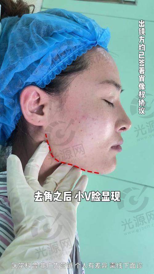 如何预约杭州时光陈小平医生的手术